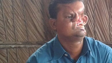 बाघ ने नोंच लिया था इस शख्स का चेहरा, 20 साल तक रखा छुपाकर दुनिया से!