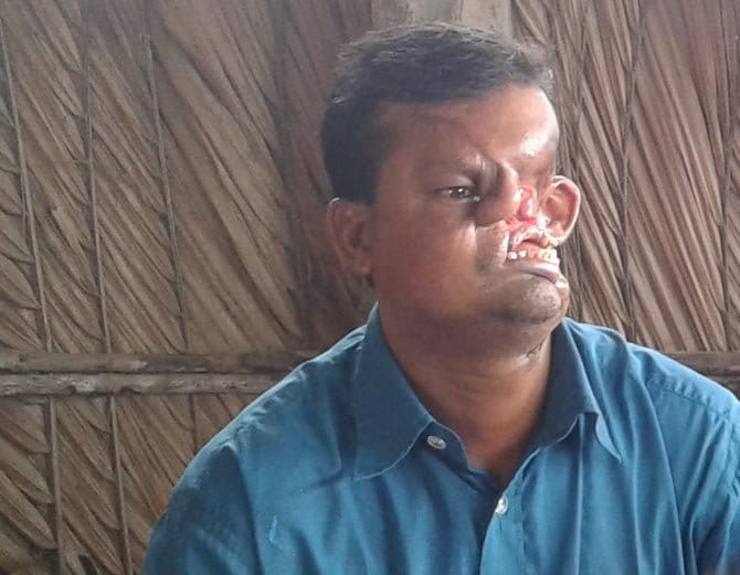 बाघ ने नोंच लिया था इस शख्स का चेहरा, 20 साल तक रखा छुपाकर दुनिया से!