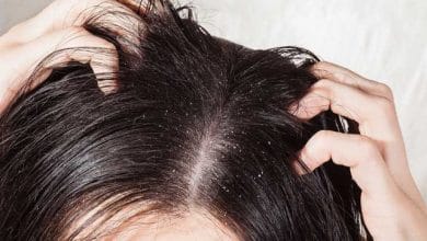 Stop Hair fall: सर्दी में ना करे ये गलती नहीं तो सिर में हो सकती है डैंड्रफ, झड़ने लगेंगे बाल- घरेलू उपाय