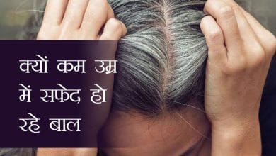 कम उम्र मे बाल सफेद क्यो हो जा रहे हैं, सफेद बाल कैसे रोके?