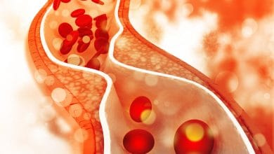 Bad Cholesterol: 5 तरह के लोगों के खून में तेजी से बढ़ता है बैड कोलेस्ट्रॉल, हार्ट अटैक का खतरा