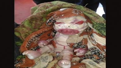 भारत में जन्मा एलियन जैसा बच्चा, देखने के लिए लगी लोगों की भीड़