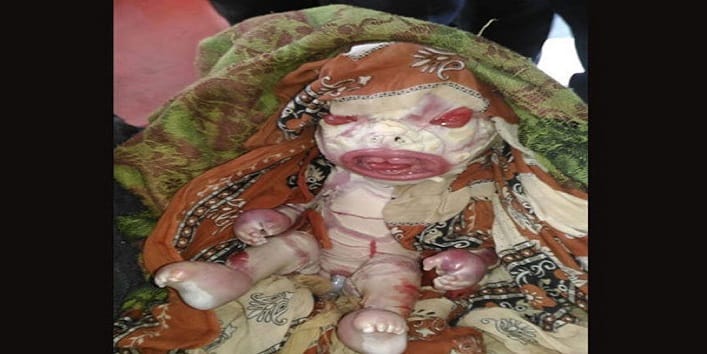 भारत में जन्मा एलियन जैसा बच्चा, देखने के लिए लगी लोगों की भीड़