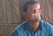 बाघ ने नोंच लिया था इस शख्स का चेहरा, 20 साल तक रखा छुपाकर दुनिया से!