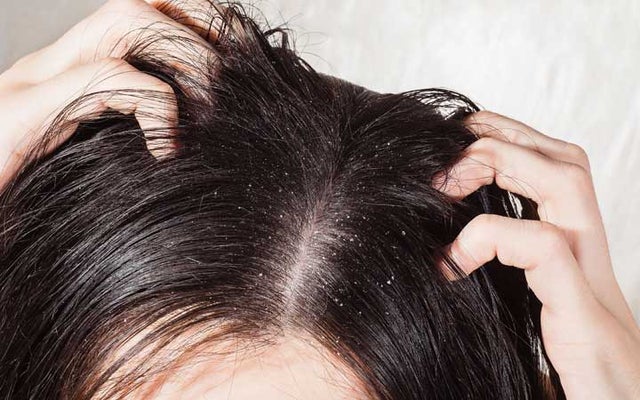 Stop Hair Fall