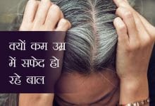 कम उम्र मे बाल सफेद क्यो हो जा रहे हैं, सफेद बाल कैसे रोके?